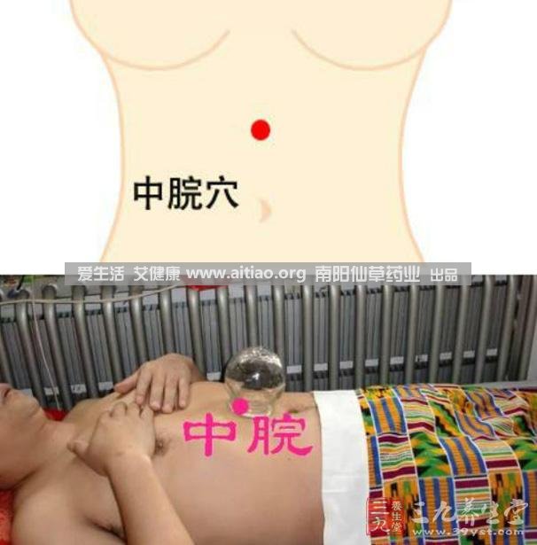 中脘穴位于腹部正中線(xiàn)，臍上4寸的位置上。每天艾灸10-15分鐘，能有效緩解胃部不適的癥狀，同時(shí)有助于祛濕。